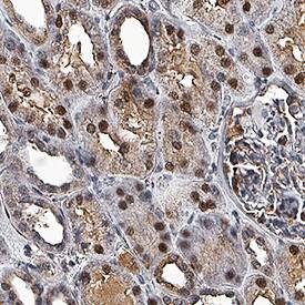 PPM1D antibody in Human Kidney by Immunohistochemistry (IHC-P).