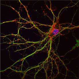 PPP1R9B antibody in Rat Neurons by Immunocytochemistry (ICC).