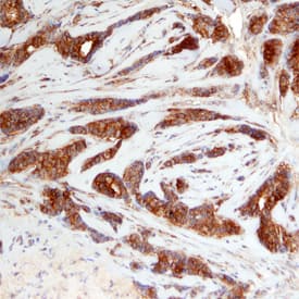 PRAS40 antibody in Human Breast by Immunohistochemistry (IHC-P).