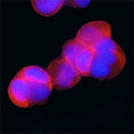 Phospho-PRAS40 (T246) antibody in MCF-7 Human Cell Line by Immunocytochemistry (ICC).