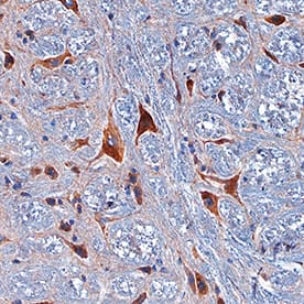 PRAT4A antibody in Mouse Brain by Immunohistochemistry (IHC-P).