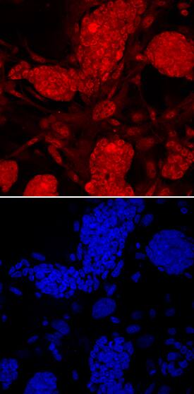 PRDM14 antibody in D3 Mouse Embryonic Stem Cells by Immunocytochemistry (ICC).