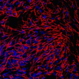 PRELP antibody in Human Mesenchymal Stem Cells by Immunocytochemistry (ICC).