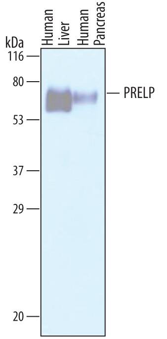 Detection of Human PRELP antibody by Western Blot.