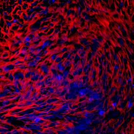 PRELP antibody in Human Chondrocytes by Immunocytochemistry (ICC).