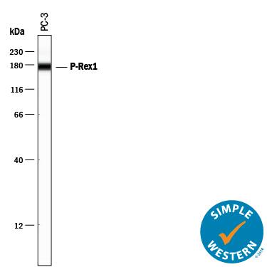 Detection of Human P-Rex1 antibody by Simple WesternTM.
