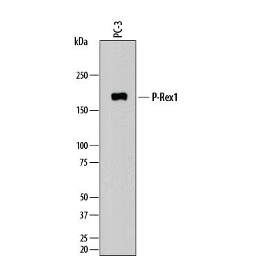 Detection of Human P-Rex1 antibody by Western Blot.