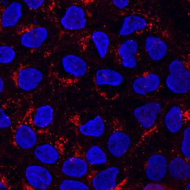 PSAP antibody in A431 Human Cell Line by Immunocytochemistry (ICC).
