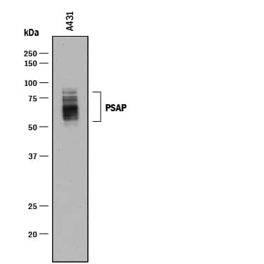 Detection of Human PSAP antibody by Western Blot.