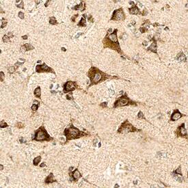 PSENEN antibody in Human Brain by Immunohistochemistry (IHC-P).