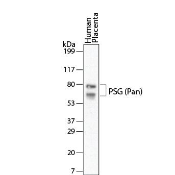 Detection of Human PSG by Western Blot. Detection of Human PSG antibody by Western Blot.