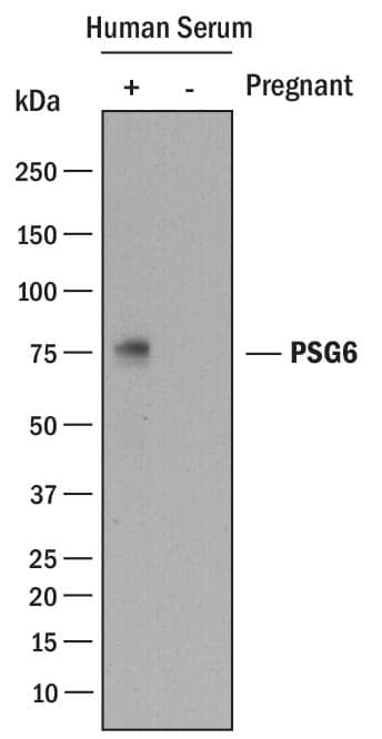 Detection of Human PSG6 antibody by Western Blot.