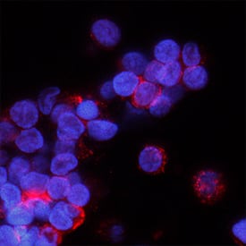 PSGL-1/CD162 antibody in Human PBMCs by Immunocytochemistry (ICC).