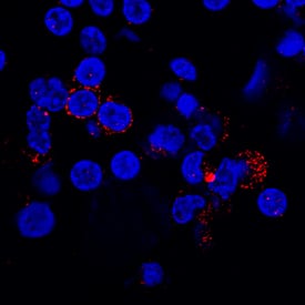PSGL-1/CD162 antibody in Human PBMCs by Immunocytochemistry (ICC).