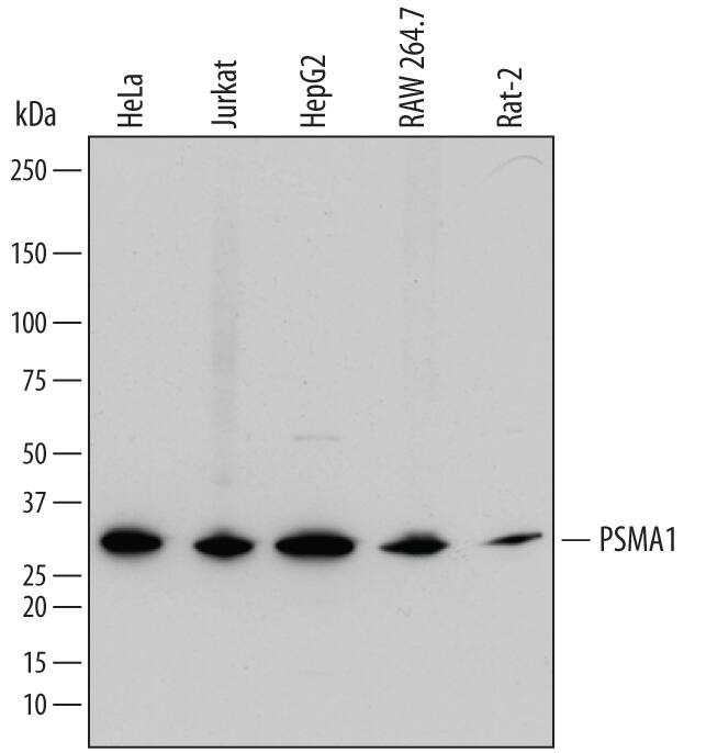 Detection of Human, Mouse, and Rat PSMA1 antibody by Western Blot.