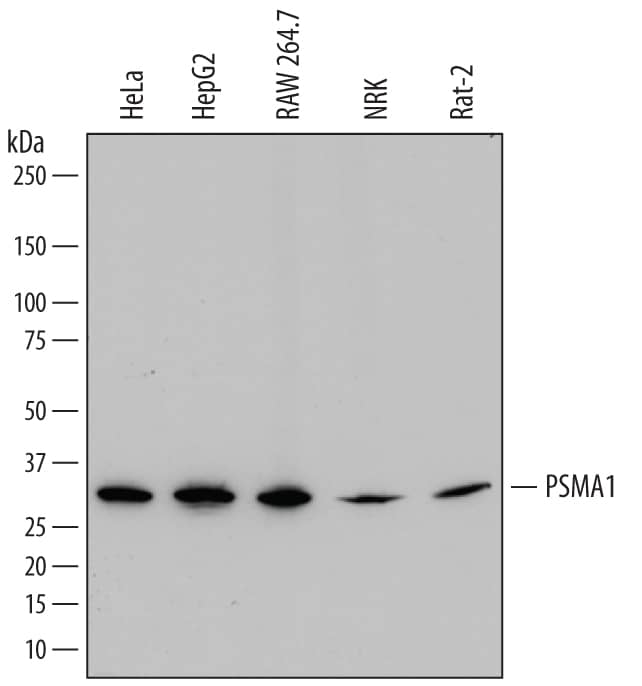 Detection of Human, Mouse, and Rat PSMA1 antibody by Western Blot.