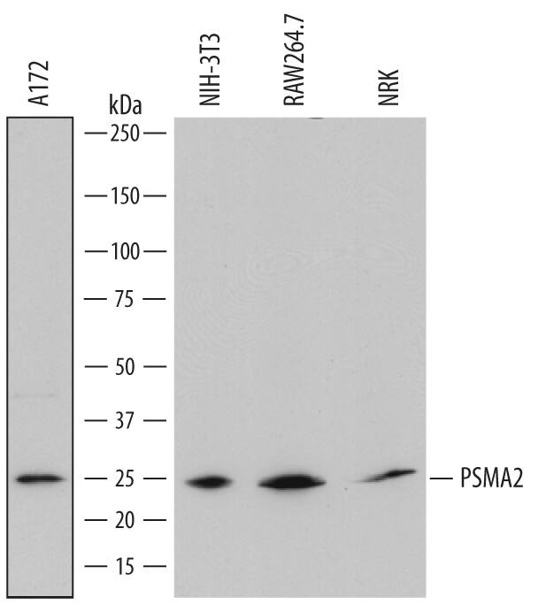 Detection of Human, Mouse, and Rat PSMA2 antibody by Western Blot.