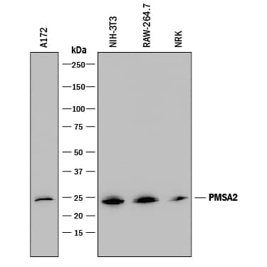 Detection of Human, Mouse, and Rat PSMA2 antibody by Western Blot.