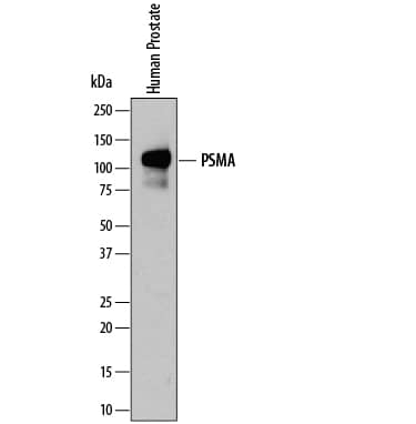 Detection of Human PSMA/FOLH1/ NAALADase I antibody by Western Blot.