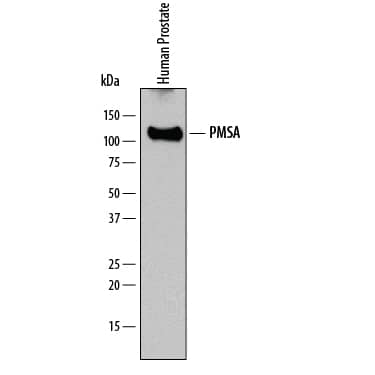 Detection of Human NAALADase I antibody by Western Blot.