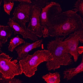NAALADase I antibody in PC-3 Human Cell Line by Immunocytochemistry (ICC).