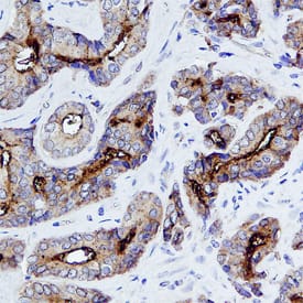 NAALADase I antibody in Human Prostate by Immunohistochemistry (IHC-P).