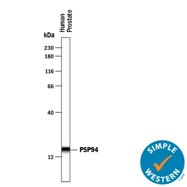 Detection of Human PSP94/MSMB antibody by Simple WesternTM.