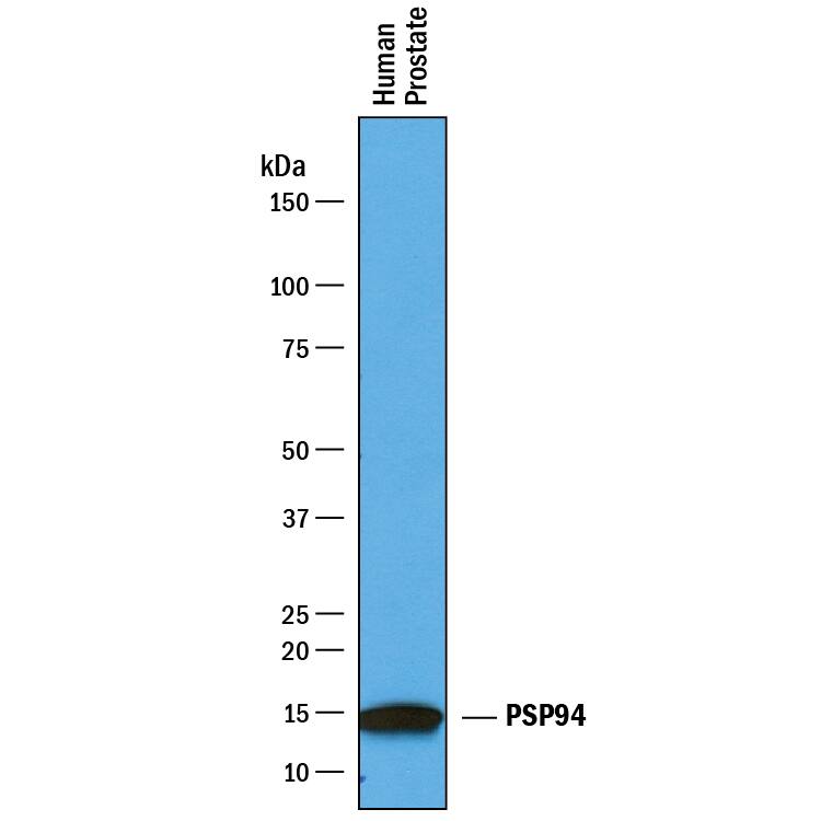 Detection of Human PSP94/MSMB antibody by Western Blot.
