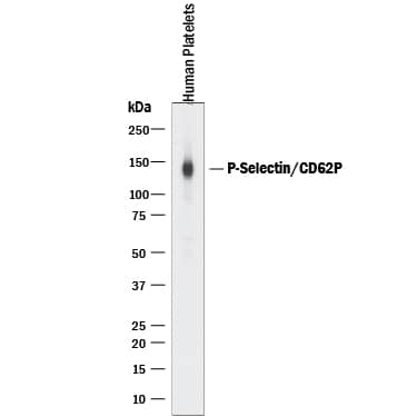 Detection of Human P-Selectin/CD62P antibody by Western Blot.