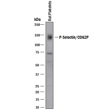Detection of Rat P-Selectin/CD62P antibody by Western Blot.