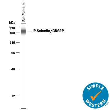 Detection of Rat P-Selectin/CD62P antibody by Simple WesternTM.