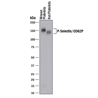 Detection of Mouse and Rat P-Selectin/CD62P antibody by Western Blot.