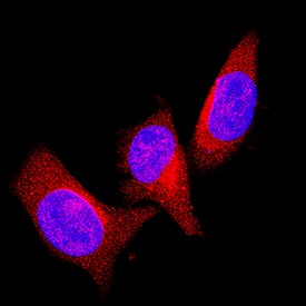 PTEN antibody in Neuro-2A Mouse Cell Line by Immunocytochemistry (ICC).