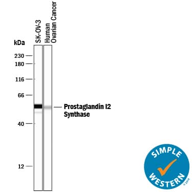 Detection of Human Prostaglandin I2 Synthase antibody by Simple WesternTM.