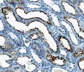 PTH1R/PTHR1 antibody in Human Kidney by Immunohistochemistry (IHC-P).