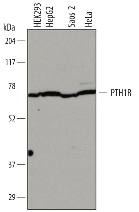 Detection of Human PTH1R/PTHR1 antibody by Western Blot.