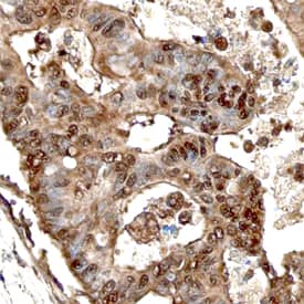 PTHLH/PTHrP antibody in Human Colon by Immunohistochemistry (IHC-P).