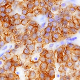 PTH antibody in Human Parathyroid Gland by Immunohistochemistry (IHC-P).
