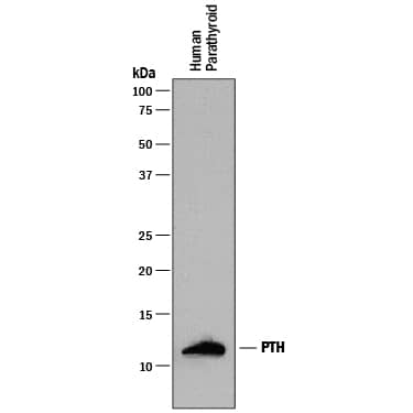 Detection of Human PTH antibody by Western Blot.