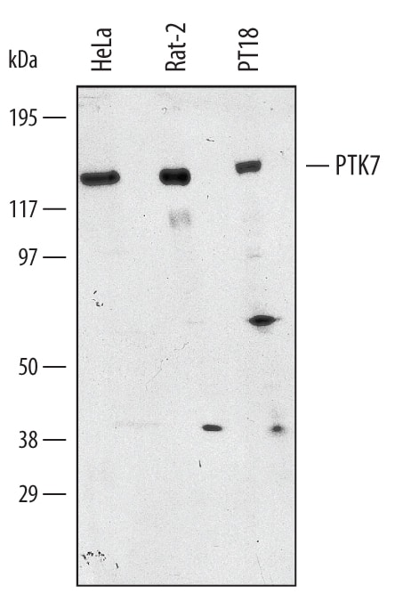 Detection of Human, Mouse, and Rat PTK7/CCK4 antibody by Western Blot.