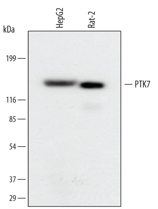 Detection of Human and Rat PTK7/CCK4 antibody by Western Blot.