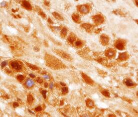 PTPN14 antibody in Human Placenta by Immunohistochemistry (IHC-P).