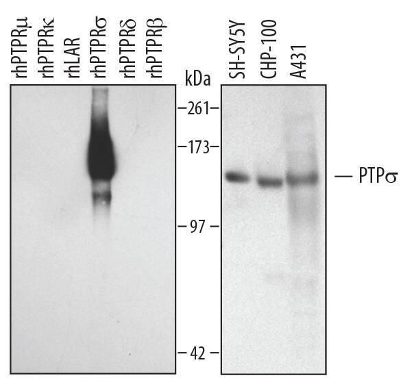 Detection of Human PTPs/PTPRS antibody by Western Blot.