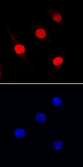 PU by Immunocytochemistry (ICC).1/Spi-1 antibody in J774A by Immunocytochemistry (ICC).1 Mouse Cell Line by Immunocytochemistry (ICC).