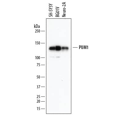 Detection of Human and Mouse PUM1 antibody by Western Blot.