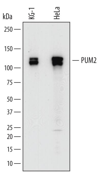 Detection of Human PUM2 antibody by Western Blot.