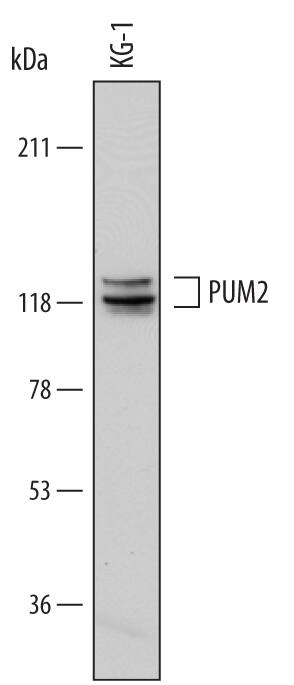 Detection of Human PUM2 antibody by Western Blot.