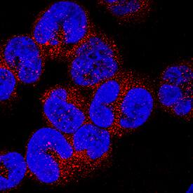 PVRIG antibody in MOLT-4 Human Cell Line by Immunocytochemistry (ICC).