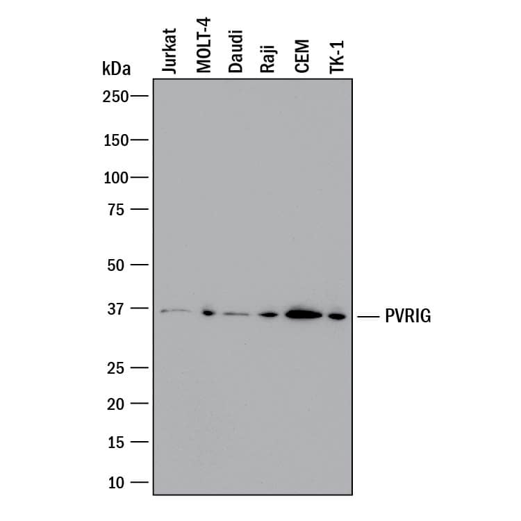 Detection of Human and Mouse PVRIG antibody by Western Blot.