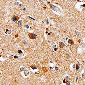 PYK2/FAK2 antibody in Human Brain by Immunohistochemistry (IHC-P).